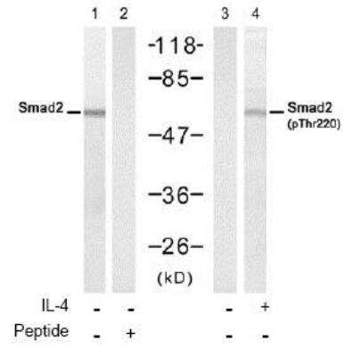 Western Blot: Smad2 [p Thr220] Antibody [NBP1-04982]